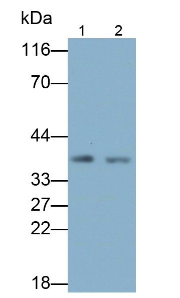 Polyclonal Antibody to Proliferating Cell Nuclear Antigen (PCNA)