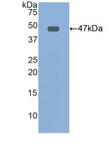 Polyclonal Antibody to Fibrillin 1 (FBN1)