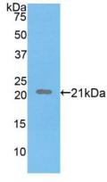 Polyclonal Antibody to Fibrillin 1 (FBN1)