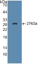 Polyclonal Antibody to Fibrillin 1 (FBN1)