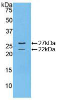 Polyclonal Antibody to Fibrillin 1 (FBN1)