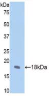 Polyclonal Antibody to Fibrillin 1 (FBN1)