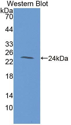 Polyclonal Antibody to Fibrillin 1 (FBN1)