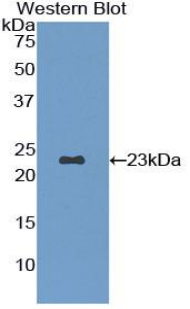 Polyclonal Antibody to Fibrillin 1 (FBN1)