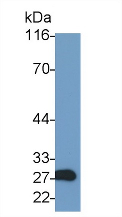 Polyclonal Antibody to Granzyme A (GZMA)