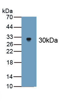 Polyclonal Antibody to Apolipoprotein B100 (APOB100)