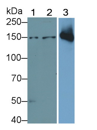 Polyclonal Antibody to Thrombospondin 1 (THBS1)