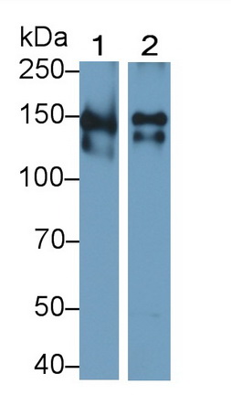 Polyclonal Antibody to Thrombospondin 1 (THBS1)