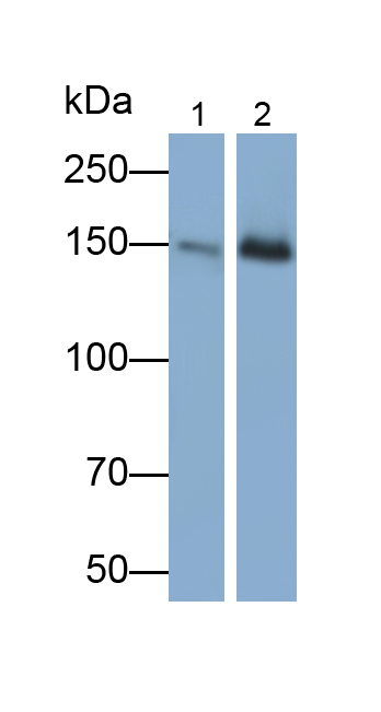 Polyclonal Antibody to Thrombospondin 1 (THBS1)