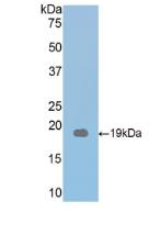 Polyclonal Antibody to Thrombospondin 1 (THBS1)