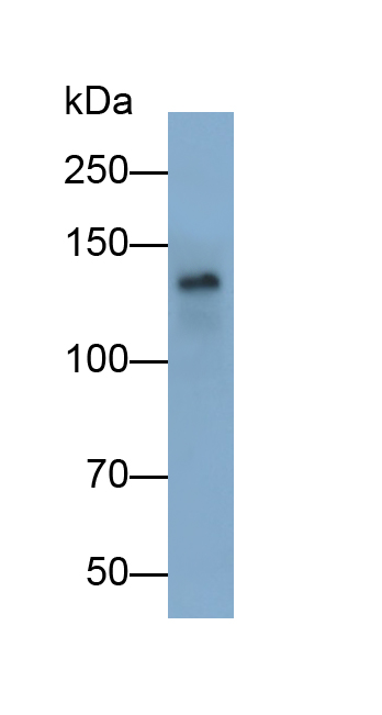 Polyclonal Antibody to Thrombospondin 1 (THBS1)