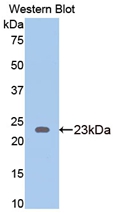 Polyclonal Antibody to Thrombospondin 1 (THBS1)