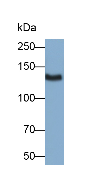 Polyclonal Antibody to Thrombospondin 1 (THBS1)