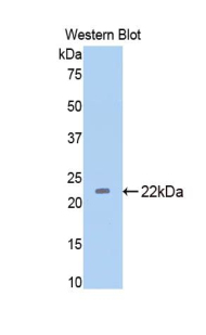 Polyclonal Antibody to Thrombospondin 1 (THBS1)