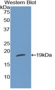 Polyclonal Antibody to Thrombospondin 1 (THBS1)