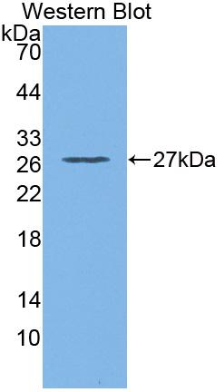 Polyclonal Antibody to Glutathione S Transferase Theta 2 (GSTt2)