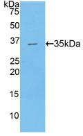 Polyclonal Antibody to Carboxypeptidase B2 (CPB2)