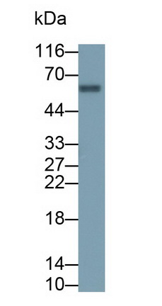 Polyclonal Antibody to Carboxypeptidase B2 (CPB2)
