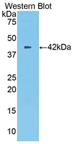 Polyclonal Antibody to Carboxypeptidase B2 (CPB2)