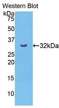 Polyclonal Antibody to Carboxypeptidase B2 (CPB2)