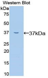Polyclonal Antibody to Transcription Factor P65 (NFKB3)