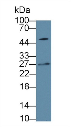 Polyclonal Antibody to Immunoglobulin Lambda 2 (Igl2)