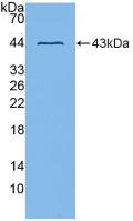 Polyclonal Antibody to A Disintegrin And Metalloprotease 8 (ADAM8)