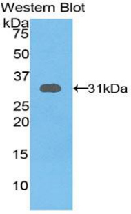 Polyclonal Antibody to Glutathione S Transferase Omega 1 (GSTo1)