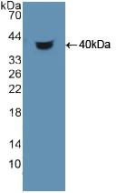 Polyclonal Antibody to Hepatoma Derived Growth Factor (HDGF)