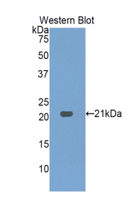 Polyclonal Antibody to Hepatoma Derived Growth Factor (HDGF)