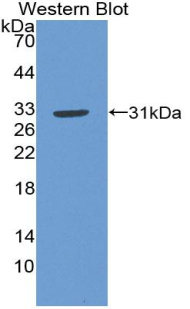 Polyclonal Antibody to Nitric Oxide Synthase Trafficker (NOSTRIN)