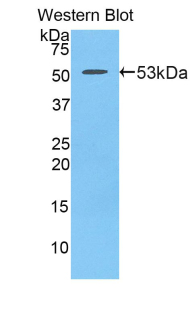 Polyclonal Antibody to Platelet Derived Growth Factor BB (PDGF BB)