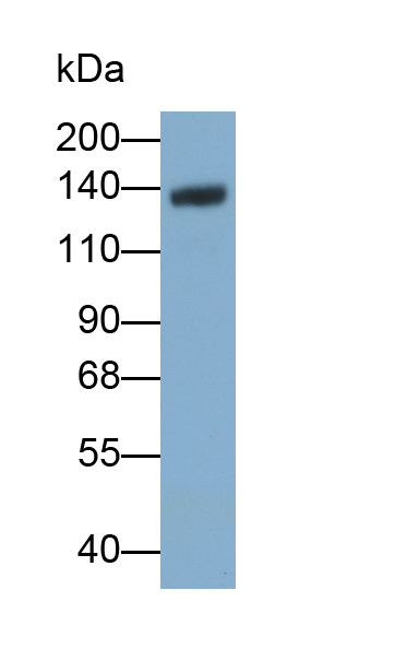 Polyclonal Antibody to Complement Factor H (CFH)