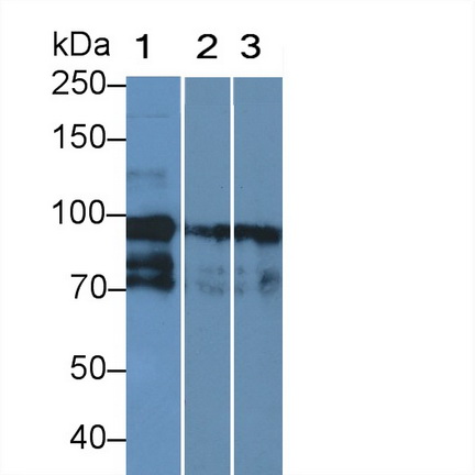 Polyclonal Antibody to Complement Factor H (CFH)