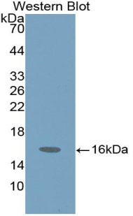 Polyclonal Antibody to Hexosaminidase B Beta (HEXb)