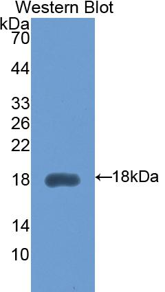 Polyclonal Antibody to Hexosaminidase B Beta (HEXb)