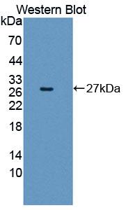 Polyclonal Antibody to Glutathione S Transferase Mu 4 (GSTm4)