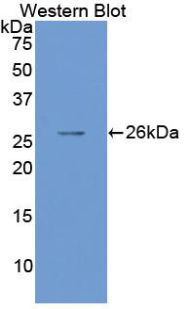 Polyclonal Antibody to Mothers Against Decapentaplegic Homolog 1 (Smad1)