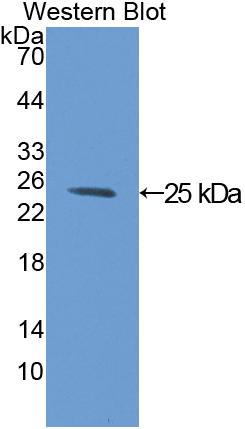 Polyclonal Antibody to Complement component 1 Q subcomponent-binding protein, mitochondrial (C1QBP)