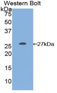 Polyclonal Antibody to Glutathione S Transferase Mu 1 (GSTM1)