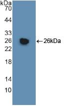 Polyclonal Antibody to Glutathione S Transferase Mu 1 (GSTM1)