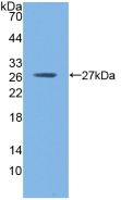 Polyclonal Antibody to Glutathione S Transferase Mu 1 (GSTM1)