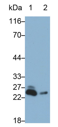 Polyclonal Antibody to Glutathione S Transferase A4 (GSTA4)