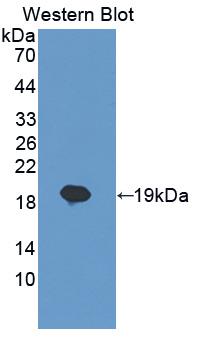 Polyclonal Antibody to Interleukin 7 (IL7)