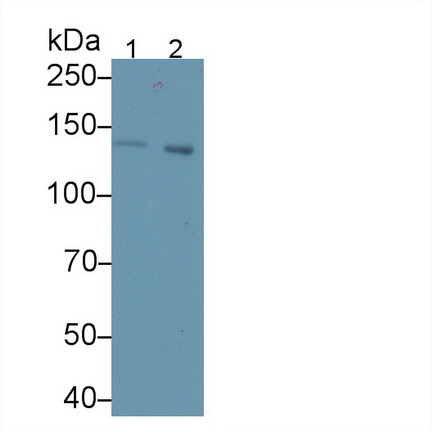 Polyclonal Antibody to Cross Linked C-Telopeptide Of Type I Collagen (CTXI)