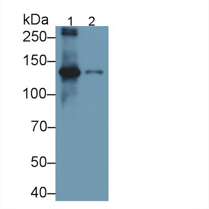 Polyclonal Antibody to Cross Linked C-Telopeptide Of Type I Collagen (CTXI)