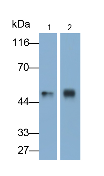 Polyclonal Antibody to Glucokinase (GCK)