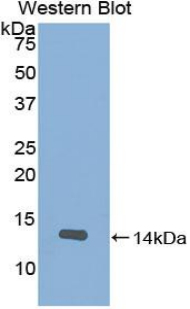 Polyclonal Antibody to Slit Homolog 2 (Slit2)