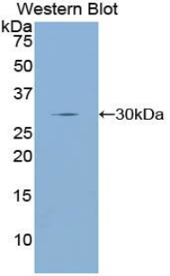 Polyclonal Antibody to Dopamine Receptor D2 (DRD2)