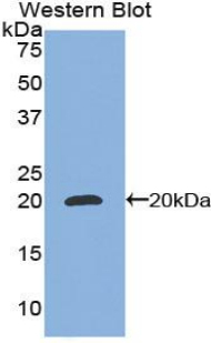 Polyclonal Antibody to CCAAT/Enhancer Binding Protein Gamma (CEBPg)
